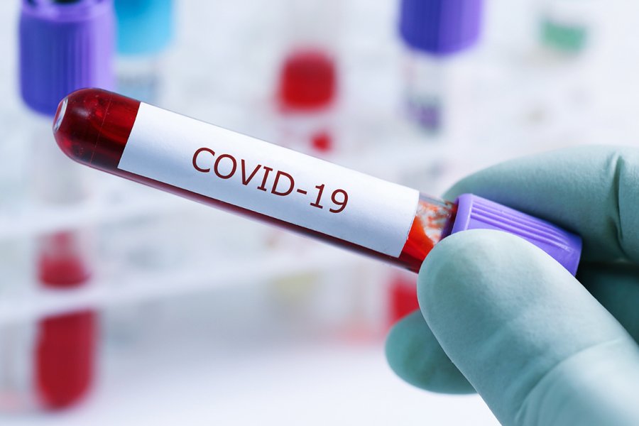 Роспотребнадзор назвал основные осложнения после коронавируса COVID-19 и их симптомы