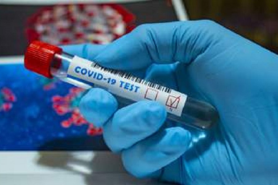 В ВОЗ сообщили о росте заболеваемости коронавирусом COVID-19 во всем мире