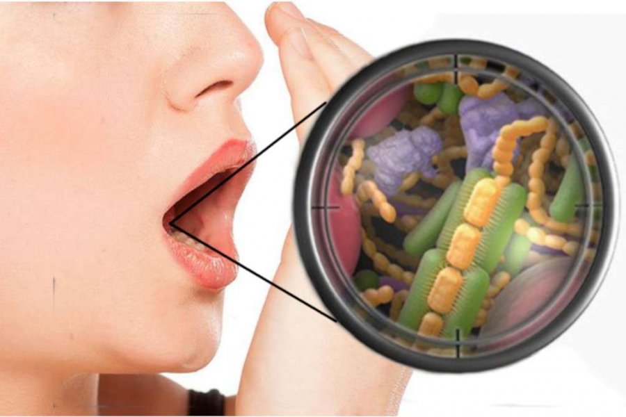 Врач РФ Валерия Галкина рассказала, что неприятный запах изо рта вызывают микробы и болезни